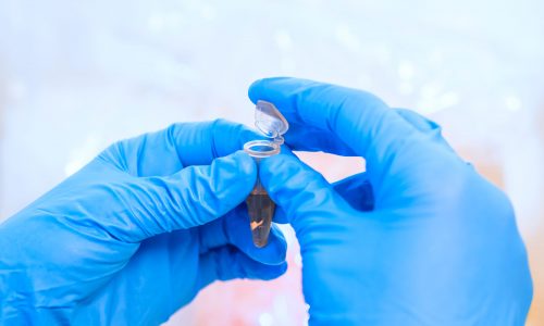 Hands of clinician holding tools during scientific experiment in modern laboratory